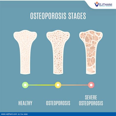 Osteoporosis